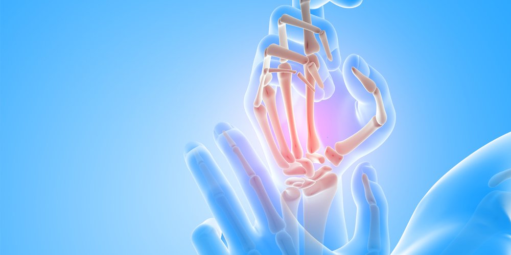 Orthopedics